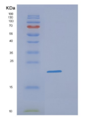 Recombinant Human DHH Protein,Recombinant Human DHH Protein