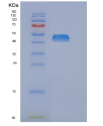 Recombinant Human DLD Protein,Recombinant Human DLD Protein