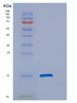 Recombinant Human DNAJC19 Protein,Recombinant Human DNAJC19 Protein