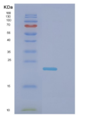 Recombinant Human DNAL1 Protein,Recombinant Human DNAL1 Protein