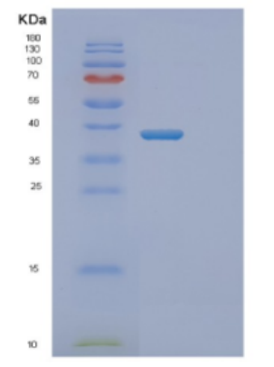 Recombinant Human DNTTIP1 Protein,Recombinant Human DNTTIP1 Protein