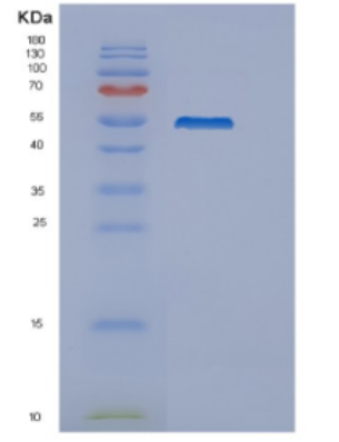 Recombinant Mouse Delta-like protein 4 Protein,Recombinant Mouse Delta-like protein 4 Protein