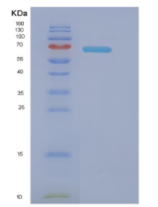 Recombinant E.coli Dnak (full length; 1-638) Protein,Recombinant E.coli Dnak (full length; 1-638) Protein