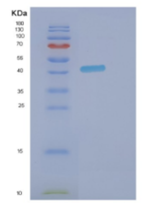 Recombinant Human DNMT3L Protein,Recombinant Human DNMT3L Protein