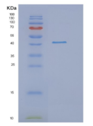 Recombinant Human DRG1 Protein,Recombinant Human DRG1 Protein