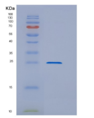 Recombinant E.coli DsbG Protein,Recombinant E.coli DsbG Protein