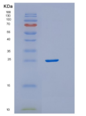 Recombinant Human DTD1 Protein,Recombinant Human DTD1 Protein