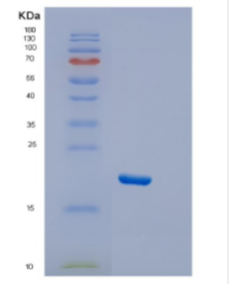 Recombinant Human DTD2 Protein,Recombinant Human DTD2 Protein