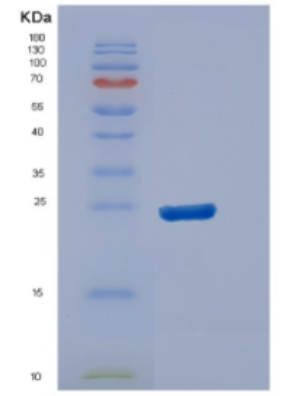 Recombinant Human DUSP13 Protein,Recombinant Human DUSP13 Protein