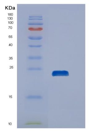 Recombinant Human DUSP21 Protein,Recombinant Human DUSP21 Protein