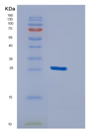 Recombinant Human DUSP26 Protein,Recombinant Human DUSP26 Protein