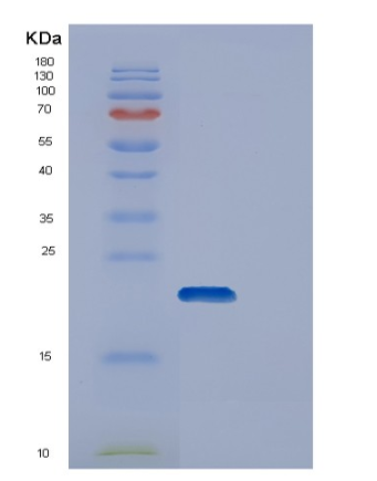 Recombinant Human DUT Protein,Recombinant Human DUT Protein