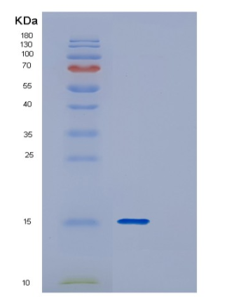 Recombinant Human DYNLT3 Protein,Recombinant Human DYNLT3 Protein