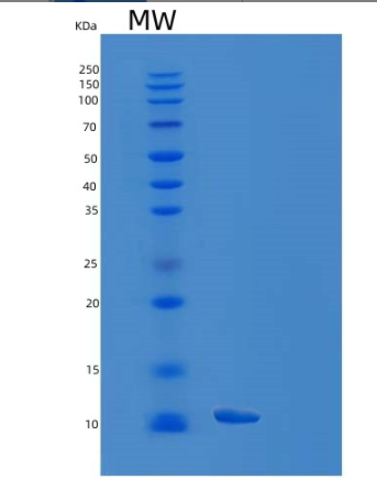 Recombinant Human EAF1 Protein,Recombinant Human EAF1 Protein