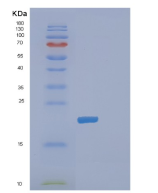 Recombinant Human DHFR Protein,Recombinant Human DHFR Protein