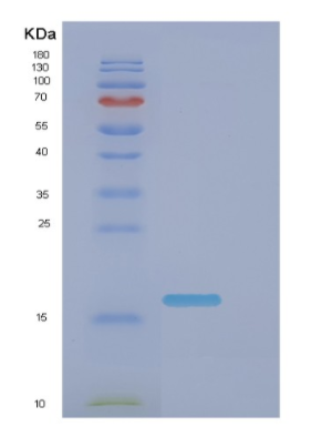 Recombinant E.coli Dnak(385-546) Protein,Recombinant E.coli Dnak(385-546) Protein