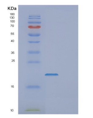 Recombinant Human DPPA3 Protein,Recombinant Human DPPA3 Protein