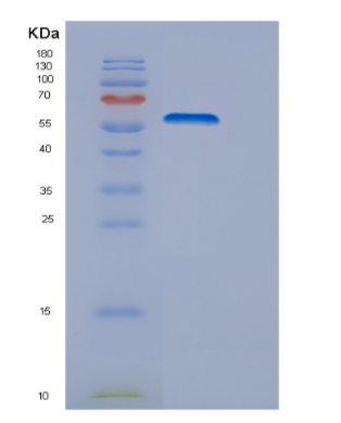 Recombinant Human DRS (Aspartyl-tRNA synthetase) Protein,Recombinant Human DRS (Aspartyl-tRNA synthetase) Protein