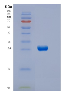 Recombinant Human DTYMK Protein,Recombinant Human DTYMK Protein