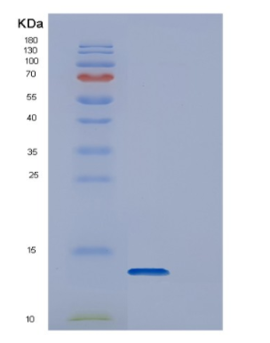 Recombinant Human DYNLL1 Protein,Recombinant Human DYNLL1 Protein