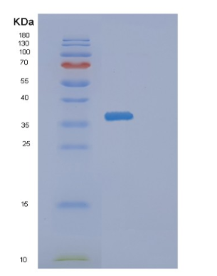 Recombinant Human DIMT1 Protein,Recombinant Human DIMT1 Protein