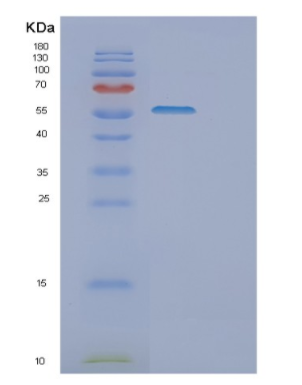 Recombinant Human Dopa decarboxylase（DDC） Protein,Recombinant Human Dopa decarboxylase