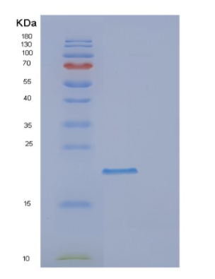 Recombinant Human DR1 Protein,Recombinant Human DR1 Protein