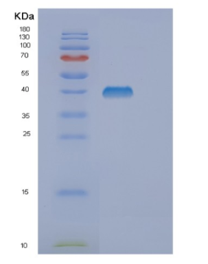 Recombinant Human DUSP10 Protein,Recombinant Human DUSP10 Protein