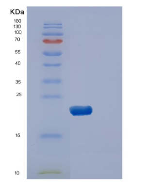 Recombinant Human DUSP3 Protein,Recombinant Human DUSP3 Protein