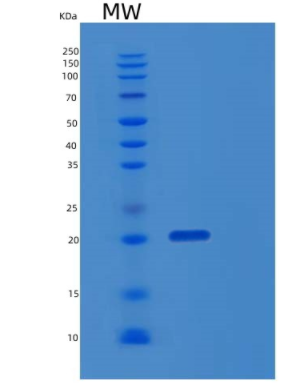 Recombinant Human EBAG9 Protein,Recombinant Human EBAG9 Protein