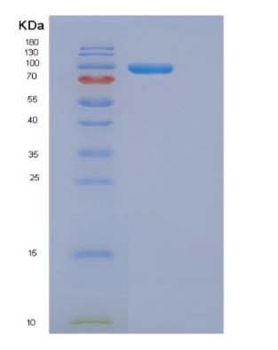 Recombinant Human DMGO (Dimethylglycine oxidase) Arthrobacter globiformis Protein,Recombinant Human DMGO (Dimethylglycine oxidase) Arthrobacter globiformis Protein