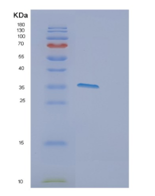 Recombinant Human DPPA4 Protein,Recombinant Human DPPA4 Protein