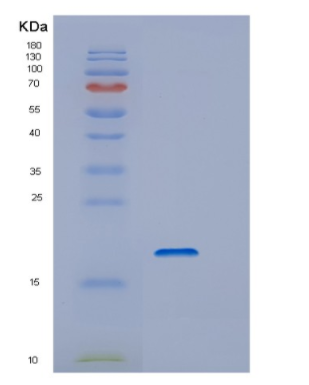 Recombinant Human DSTN Protein,Recombinant Human DSTN Protein