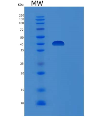 Recombinant Human DUSP6 Protein,Recombinant Human DUSP6 Protein