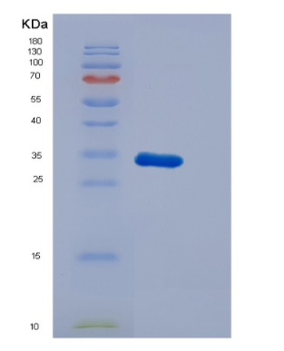 Recombinant Human Dysbindin Protein,Recombinant Human Dysbindin Protein