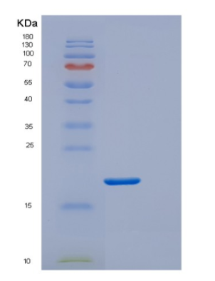 Recombinant E.coli DsbE Protein,Recombinant E.coli DsbE Protein