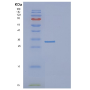 Recombinant Human DCUN1D1 Protein,Recombinant Human DCUN1D1 Protein