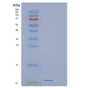 Recombinant Human DEFB116 Protein,Recombinant Human DEFB116 Protein