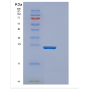 Recombinant Human DENR Protein,Recombinant Human DENR Protein