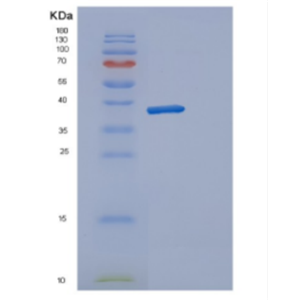 Recombinant Human DERA Protein,Recombinant Human DERA Protein