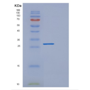 Recombinant Human DGCR6 Protein,Recombinant Human DGCR6 Protein