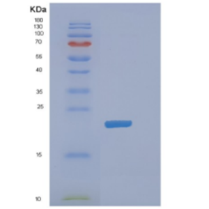 Recombinant Mouse DHFR Protein