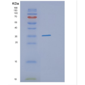 Recombinant Human DHRS9 Protein,Recombinant Human DHRS9 Protein