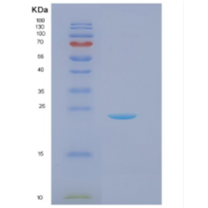 Recombinant Recombinant DJ-1(PARK7) Protein