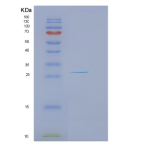 Recombinant Human DKK2 Protein,Recombinant Human DKK2 Protein