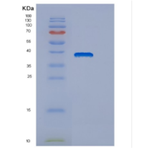 Recombinant Human DNAJB6 Protein