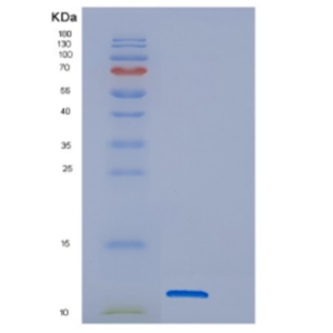 Recombinant Human DNAJC15 Protein