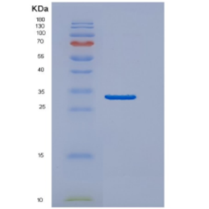 Recombinant Human DNAJB2 Protein,Recombinant Human DNAJB2 Protein