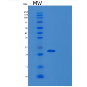 Recombinant Human DCTN6 Protein,Recombinant Human DCTN6 Protein