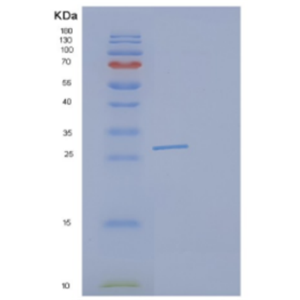 Recombinant Human DCXR Protein